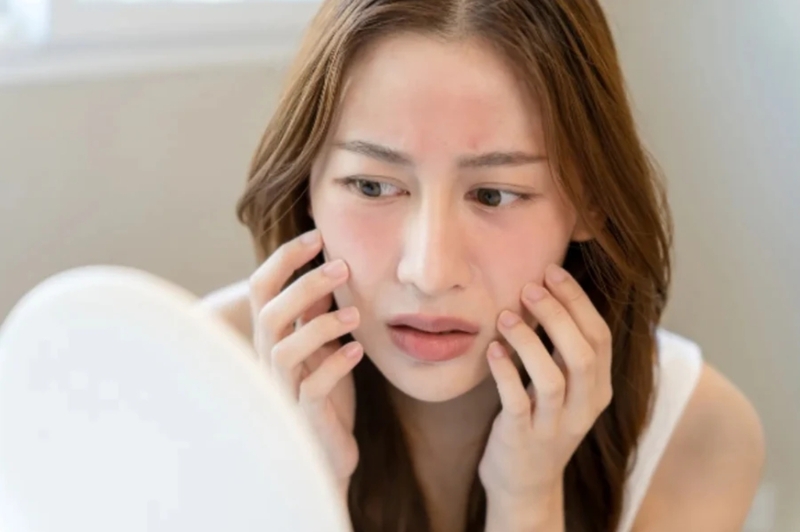 Triệt lông mặt sai cách có thể gây đỏ rát, kích ứng, nổi mụn, thâm sạm hoặc tổn thương hàng rào bảo vệ da. 