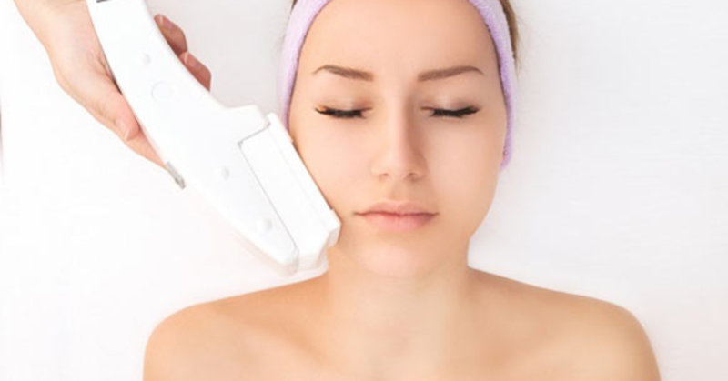 Laser hoặc IPL có thể giúp lông mặt mọc chậm và thưa hơn, nhưng cần thực hiện đúng kỹ thuật và chăm sóc da kỹ. 